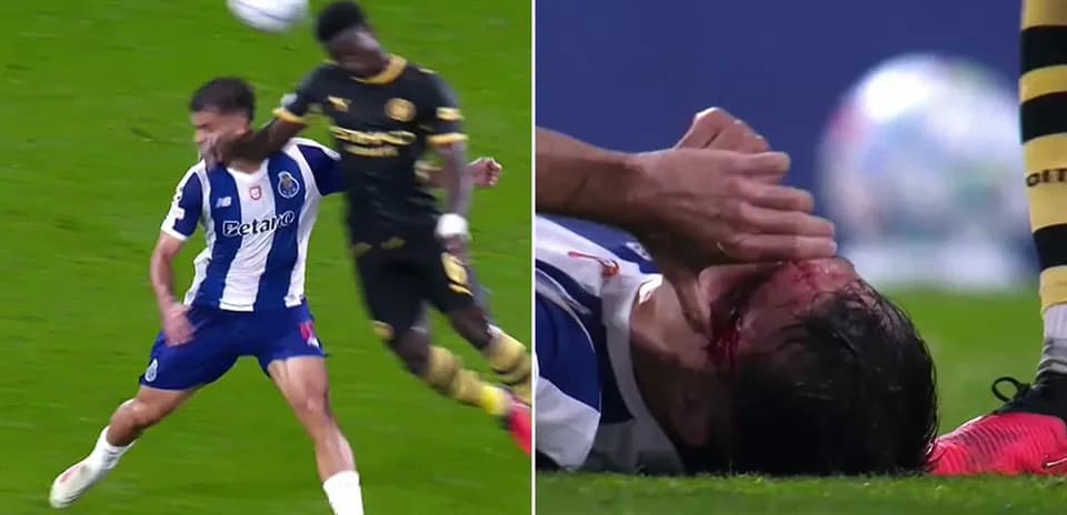 Player injured on the ground after collision